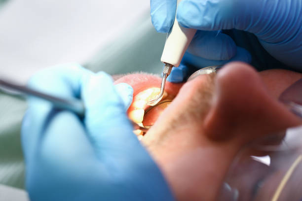 Best Emergency Broken Tooth Repair in Kent Estates, IA